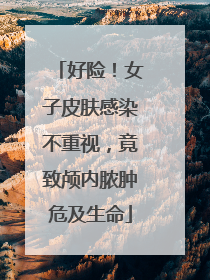 好险！女子皮肤感染不重视，竟致颅内脓肿危及生命